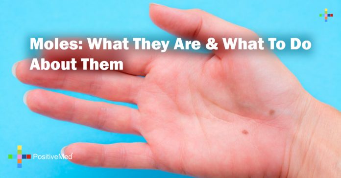 Moles: What They Are & What To Do About Them