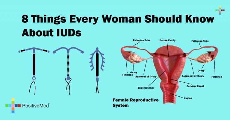 8 Things Every Woman Should Know About IUDs