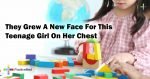 1258-They-Grew-A-New-Face-For-This-Teenage-Girl-On-Her-Chest-1