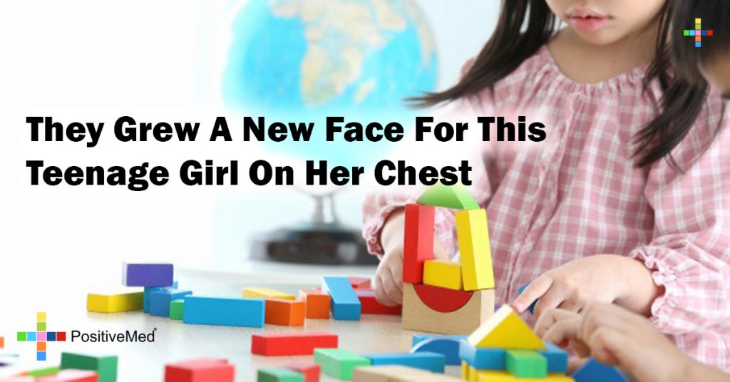 They Grew A New Face For This Teenage Girl On Her Chest