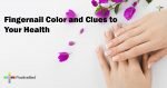 Fingernail-Color-and-Clues-to-Your-Health