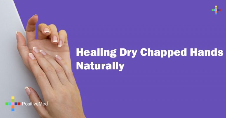 Healing Dry Chapped Hands Naturally