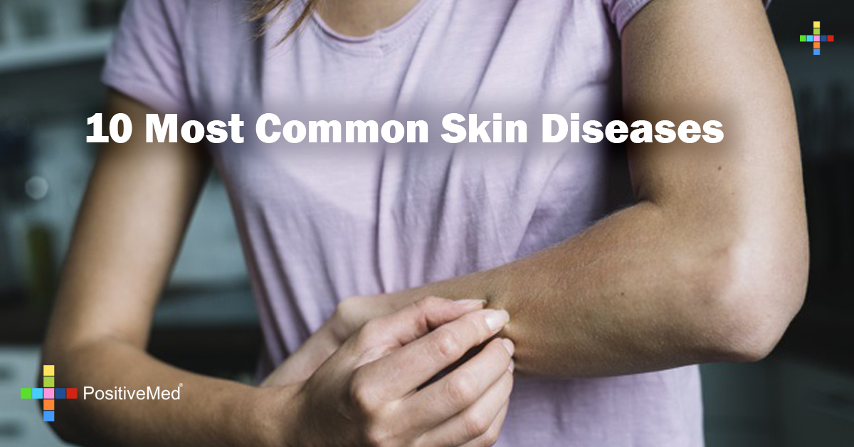 10 Most Common Skin Disorders