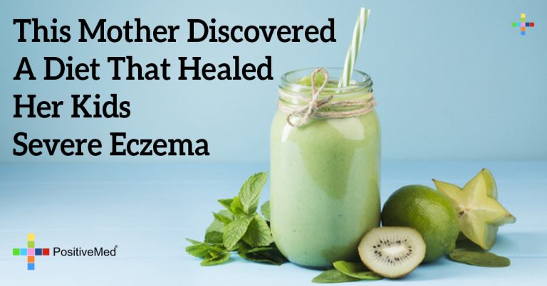 This Mother Discovered A Diet That Healed Her Kids Severe Eczema This Mother Discovered A Diet That Healed Her Kids Severe Eczema