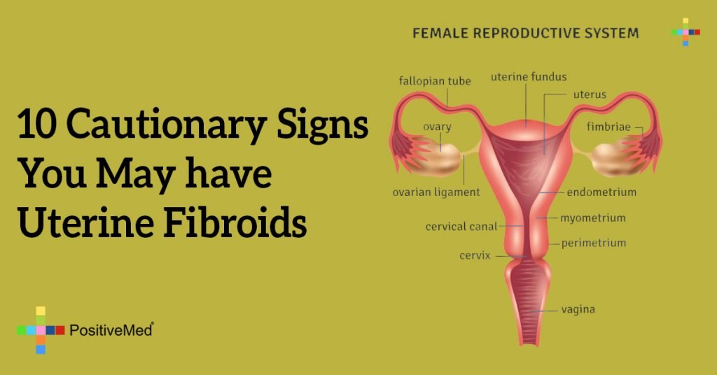10 Cautionary Signs You May have Uterine Fibroids
