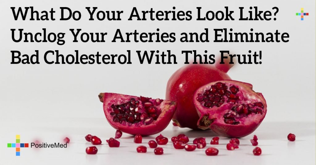 What Do Your Arteries Look Like? Unclog Your Arteries and Eliminate Bad Cholesterol With This Fruit!