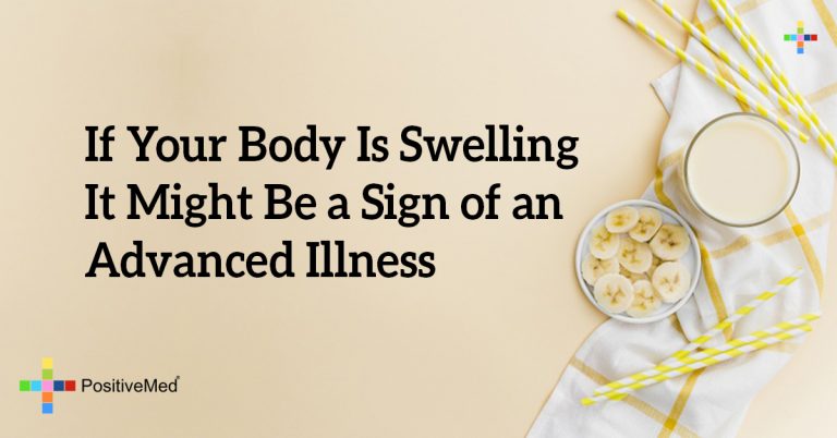 If Your Body Is Swelling It Might Be a Sign of an Advanced Illness If Your Body Is Swelling It Might Be a Sign of an Advanced Illness