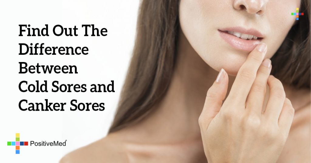 Find Out The Difference Between Cold Sores and Canker Sores