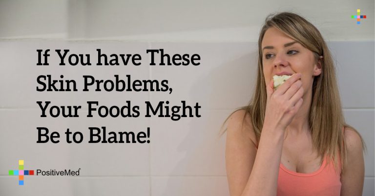 If You have These Skin Problems, Your Foods Might Be to Blame!