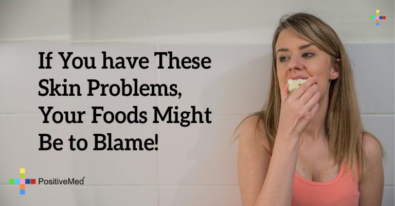 If You have These Skin Problems, Your Foods Might Be to Blame! If You have These Skin Problems, Your Foods Might Be to Blame!