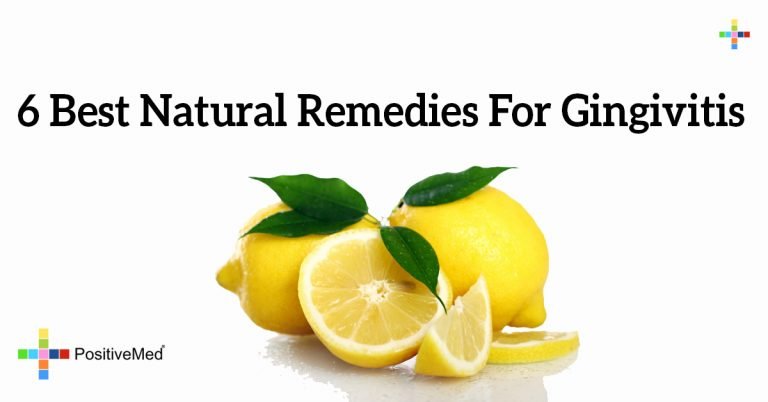 6 Best Natural Remedies For Gingivitis 6 Best Natural Remedies For Gingivitis