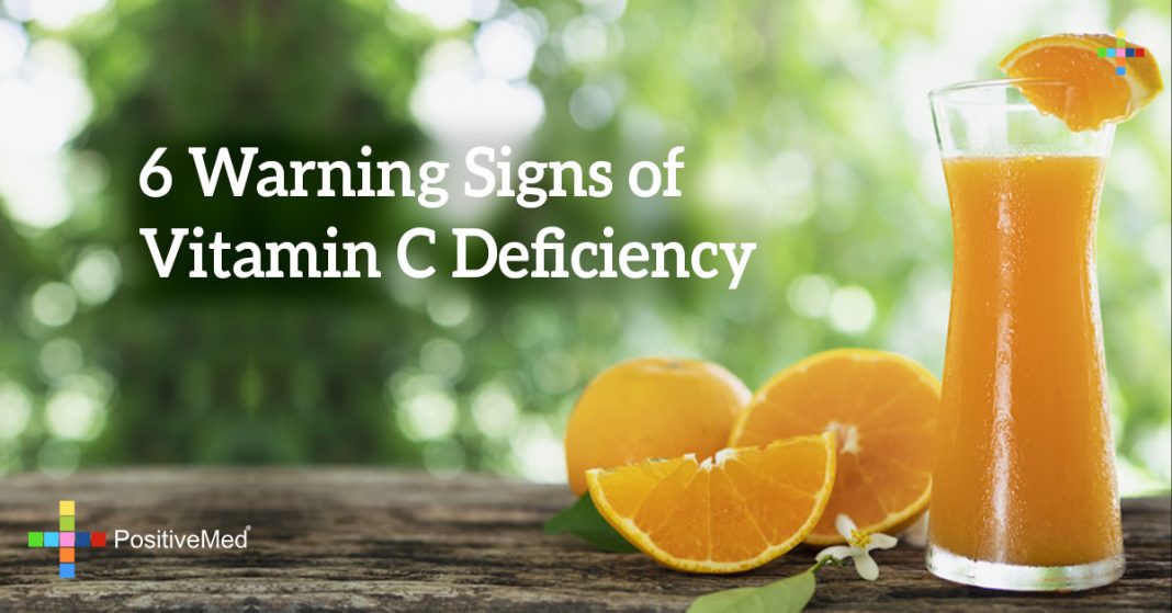 6 Warning Signs of Vitamin C Deficiency