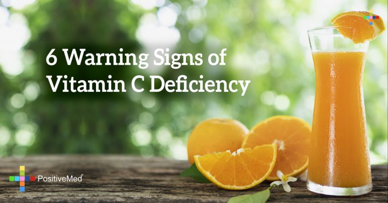 6 Warning Signs of Vitamin C Deficiency 6 Warning Signs of Vitamin C Deficiency