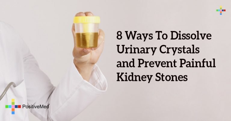 8 Ways To Dissolve Urinary Crystals and Prevent Painful Kidney Stones