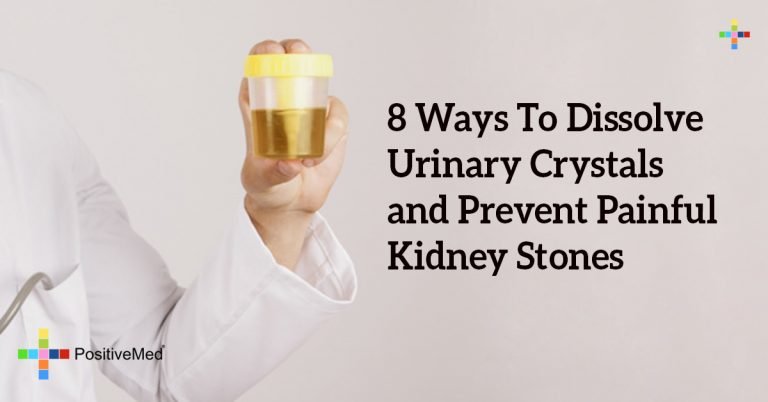 8 Ways To Dissolve Urinary Crystals and Prevent Painful Kidney Stones 8 Ways To Dissolve Urinary Crystals and Prevent Painful Kidney Stones