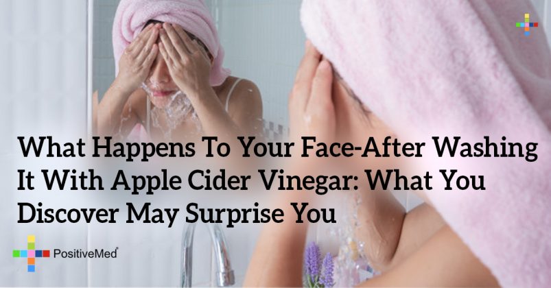 washing face with apple cider vinegar and water
