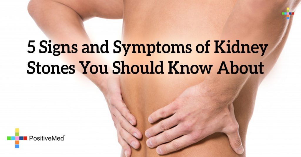 5 Signs and Symptoms of Kidney Stones You Should Know About