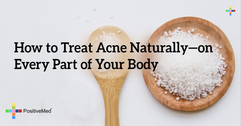 How to Treat Acne Naturally—on Every Part of Your Body