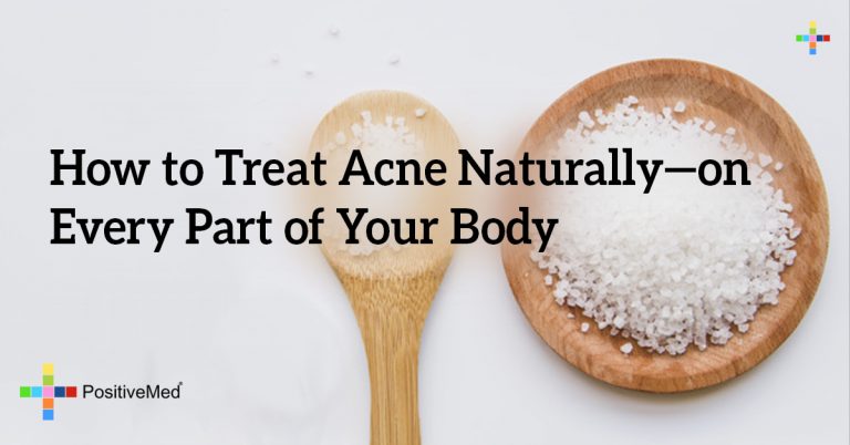 How to Treat Acne Naturally—on Every Part of Your Body How to Treat Acne Naturally—on Every Part of Your Body
