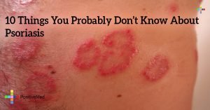 10 Things You Probably Don't Know About Psoriasis