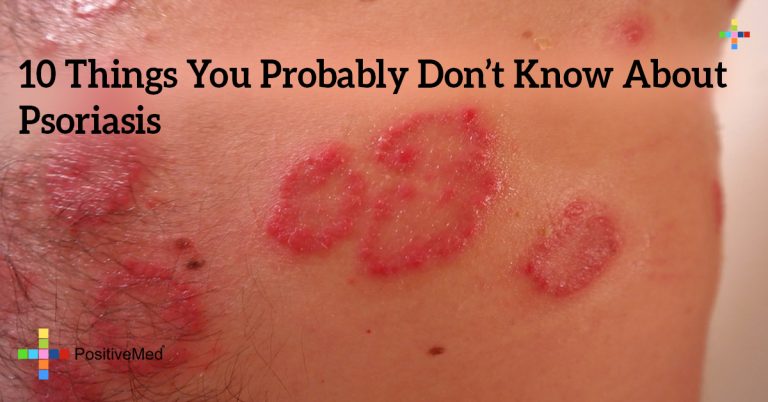 10 Things You Probably Don’t Know About Psoriasis