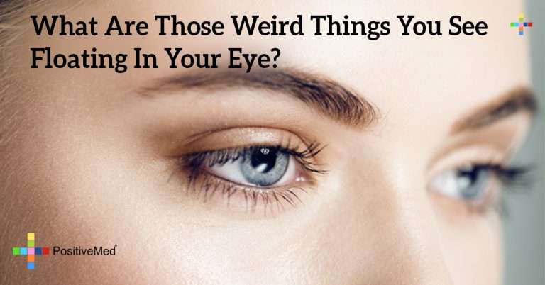 What Are Those Weird Things You See Floating In Your Eye?