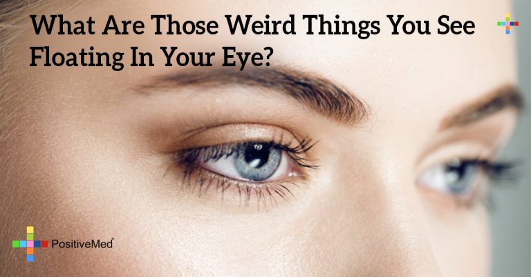 What Are Those Weird Things You See Floating In Your Eye? What Are Those Weird Things You See Floating In Your Eye?