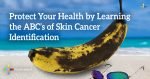 4255-Protect-Your-Health-by-Learning-the-ABC’s-of-Skin-Cancer-Identification-1