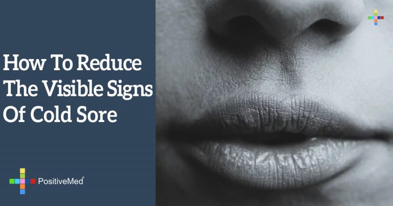 How To Reduce The Visible Signs Of Cold Sore