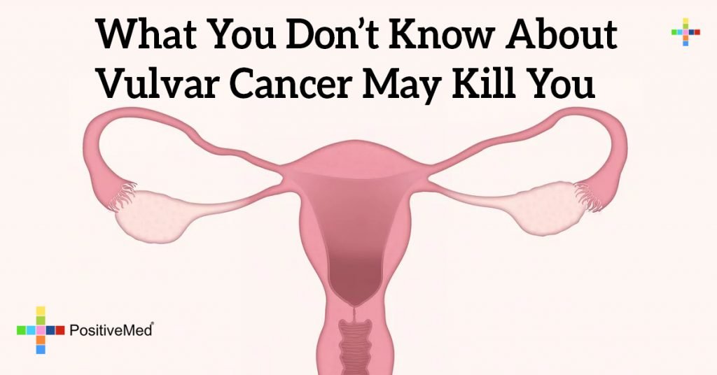What You Don't Know About Vulvar Cancer May Kill You