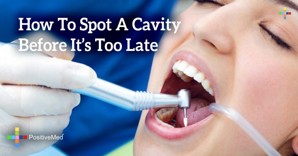 How To Spot A Cavity Before It's Too Late