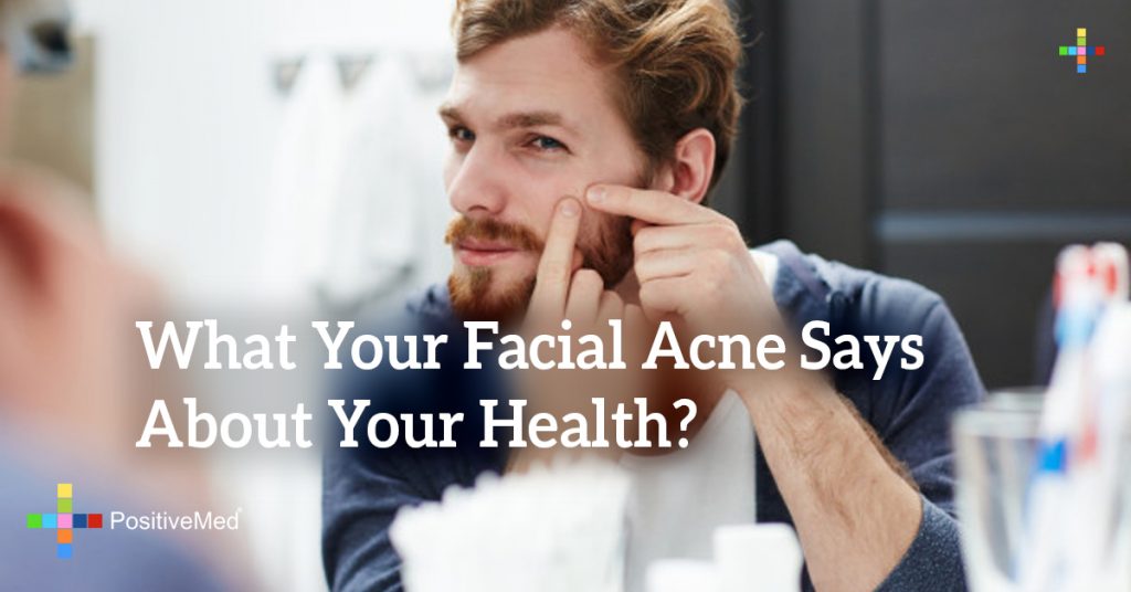 What Your Facial Acne Says About Your Health?