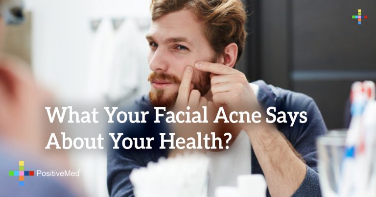 What Your Facial Acne Says About Your Health? What Your Facial Acne Says About Your Health?