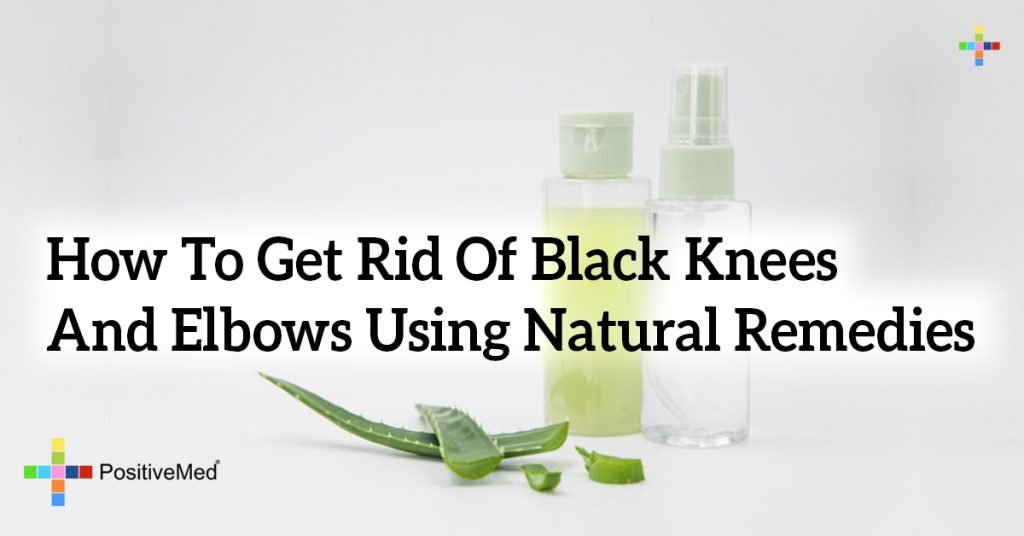 How To Get Rid Of Black Knees And Elbows Using Natural Remedies