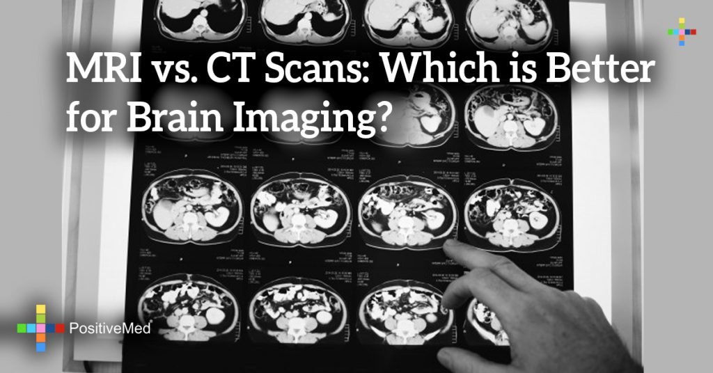 MRI vs. CT Scans: Which is Better for Brain Imaging?