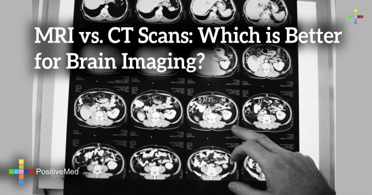 MRI vs. CT Scans: Which is Better for Brain Imaging? MRI vs. CT Scans: Which is Better for Brain Imaging?