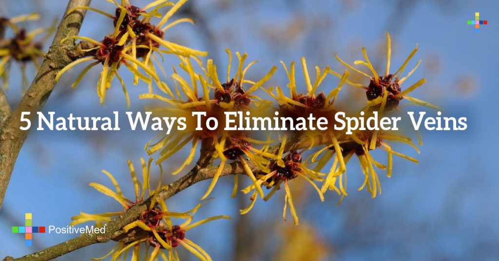 5 Natural Ways To Eliminate Spider Veins