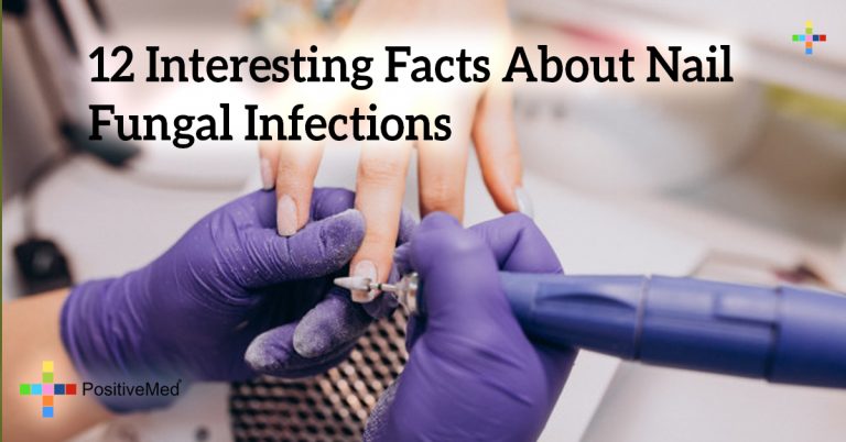 12 Interesting Facts About Nail Fungal Infections