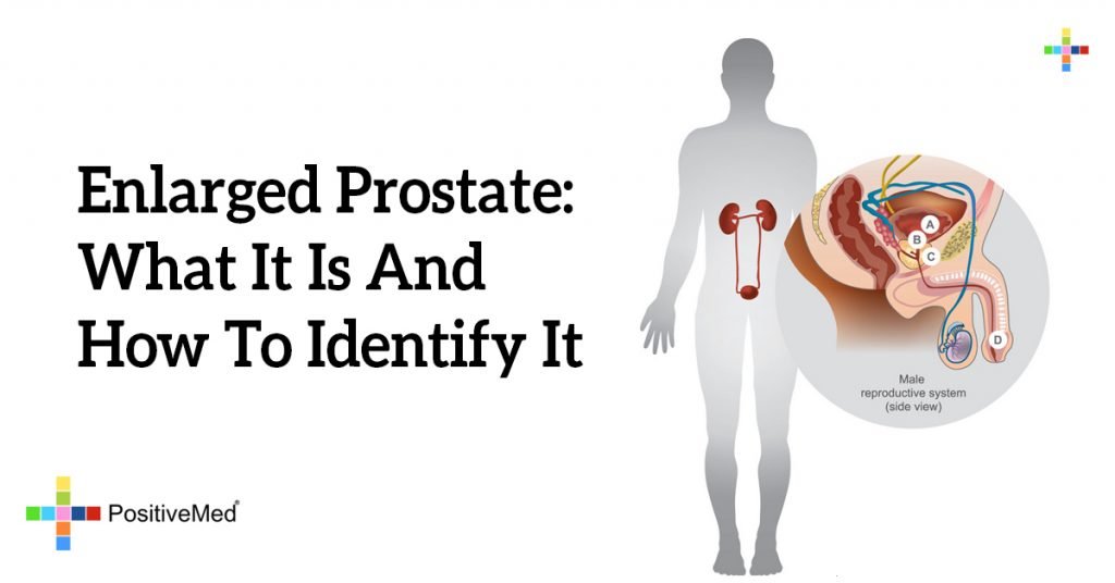 Enlarged Prostate: What It Is And How To Identify It
