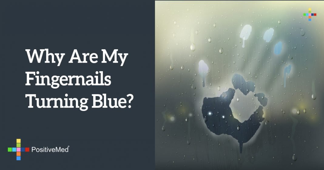 Why Are My Fingernails Turning Blue?
