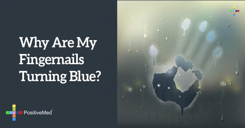 Why Are My Fingernails Turning Blue 
