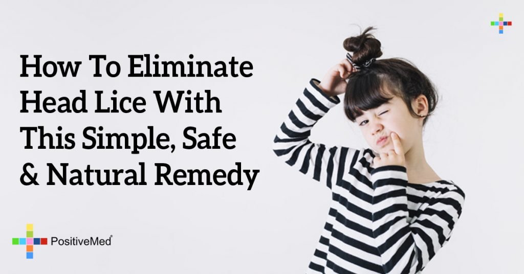How To Eliminate Head Lice With This Simple, Safe & Natural Remedy