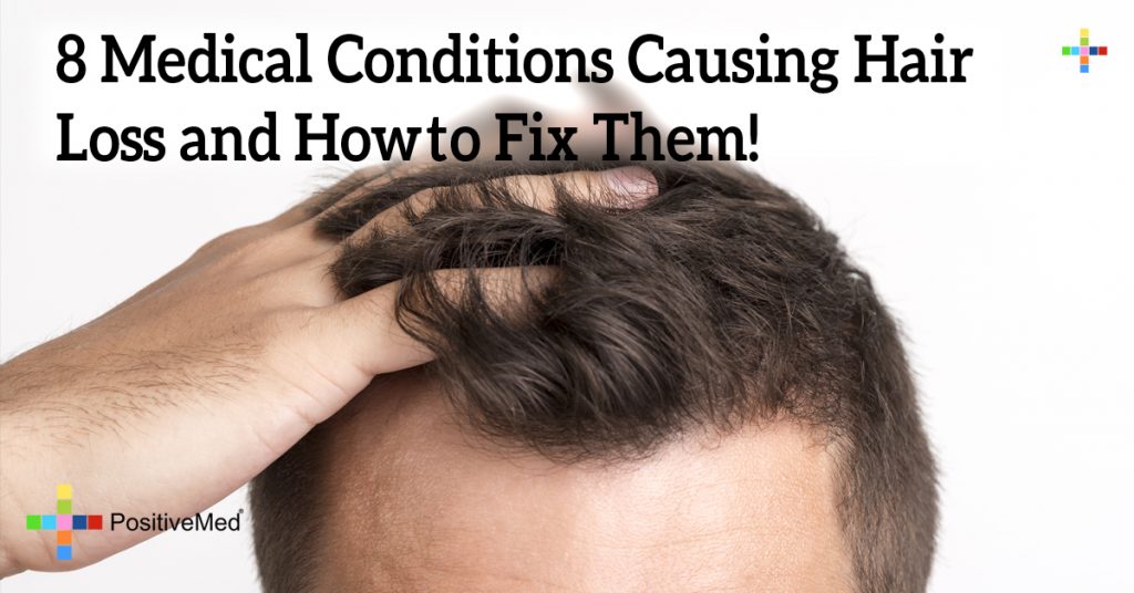 8 Medical Conditions Causing Hair Loss and How to Fix Them!