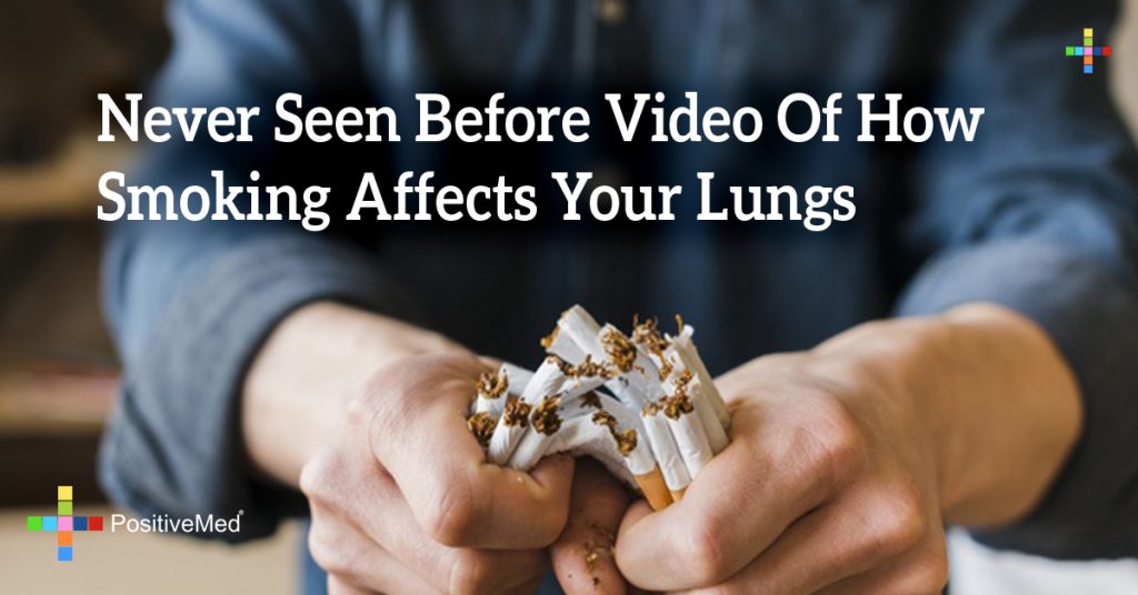 Never Seen Before Video Of How Smoking Affects Your Lungs