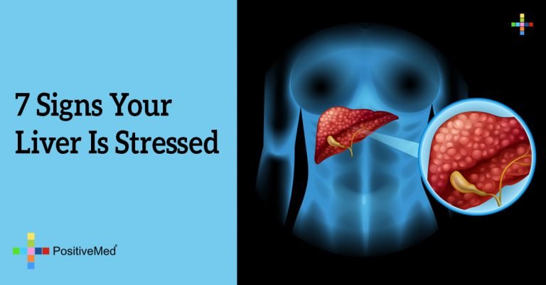 7 Signs Your Liver Is Stressed 7 Signs Your Liver Is Stressed