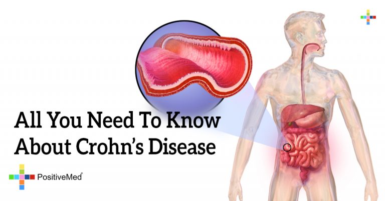 All You Need To Know About Crohn’s Disease