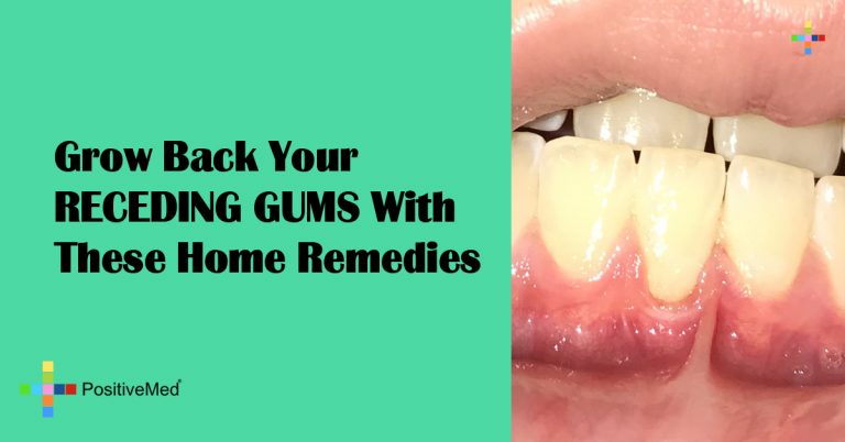 Grow Back Your RECEDING GUMS With These Home Remedies Grow Back Your RECEDING GUMS With These Home Remedies