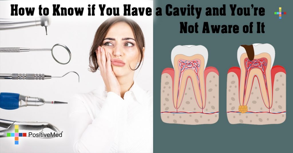How to Know if You Have a Cavity and You're Not Aware of It