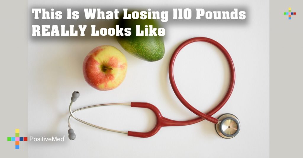 This Is What Losing 110 Pounds REALLY Looks Like