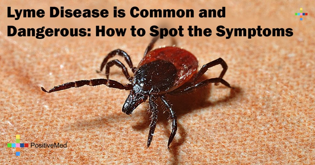 Lyme Disease is Common and Dangerous: How to Spot the Symptoms